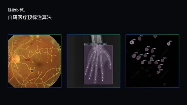 澳鹏MediGo平台集成医疗专用NER模型、问答对自动生成系统和自研预标注算法