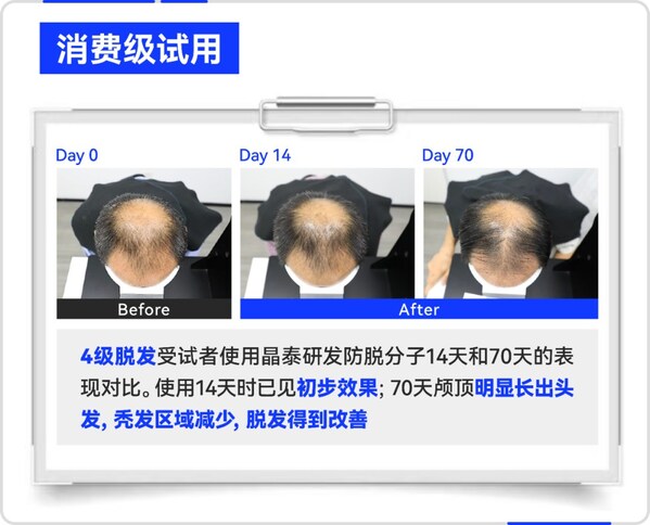 晶泰科技 AI 研发生发分子消费级试用效果案例