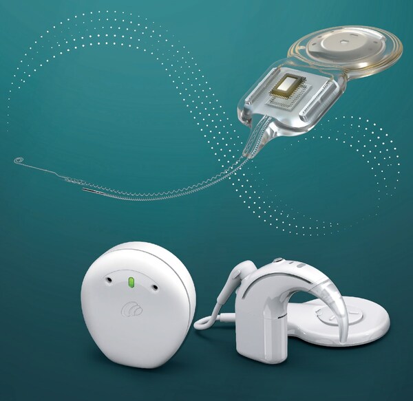 科利耳Nucleus™ Nexa智能人工耳蜗系统