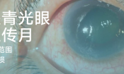 一月是青光眼意识宣传月