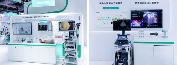 富士胶片带来国产新品ELUXEO 8000内镜系统（左）及ARIETTA 650超声诊断系统（右）